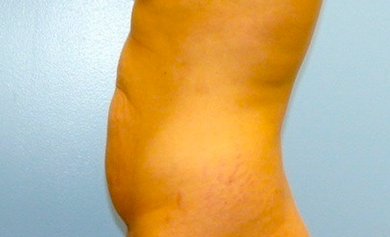 Before image