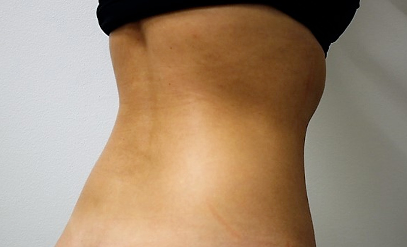After image