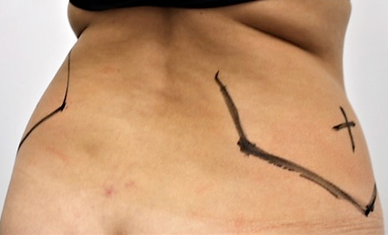 Before image