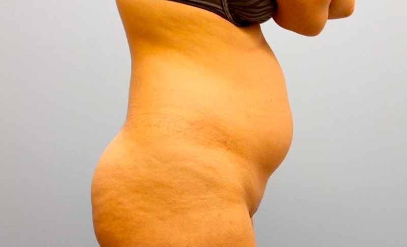 Before image