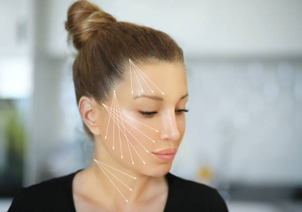 Woman looking down with white lines on her face indicating PDO thread placement.