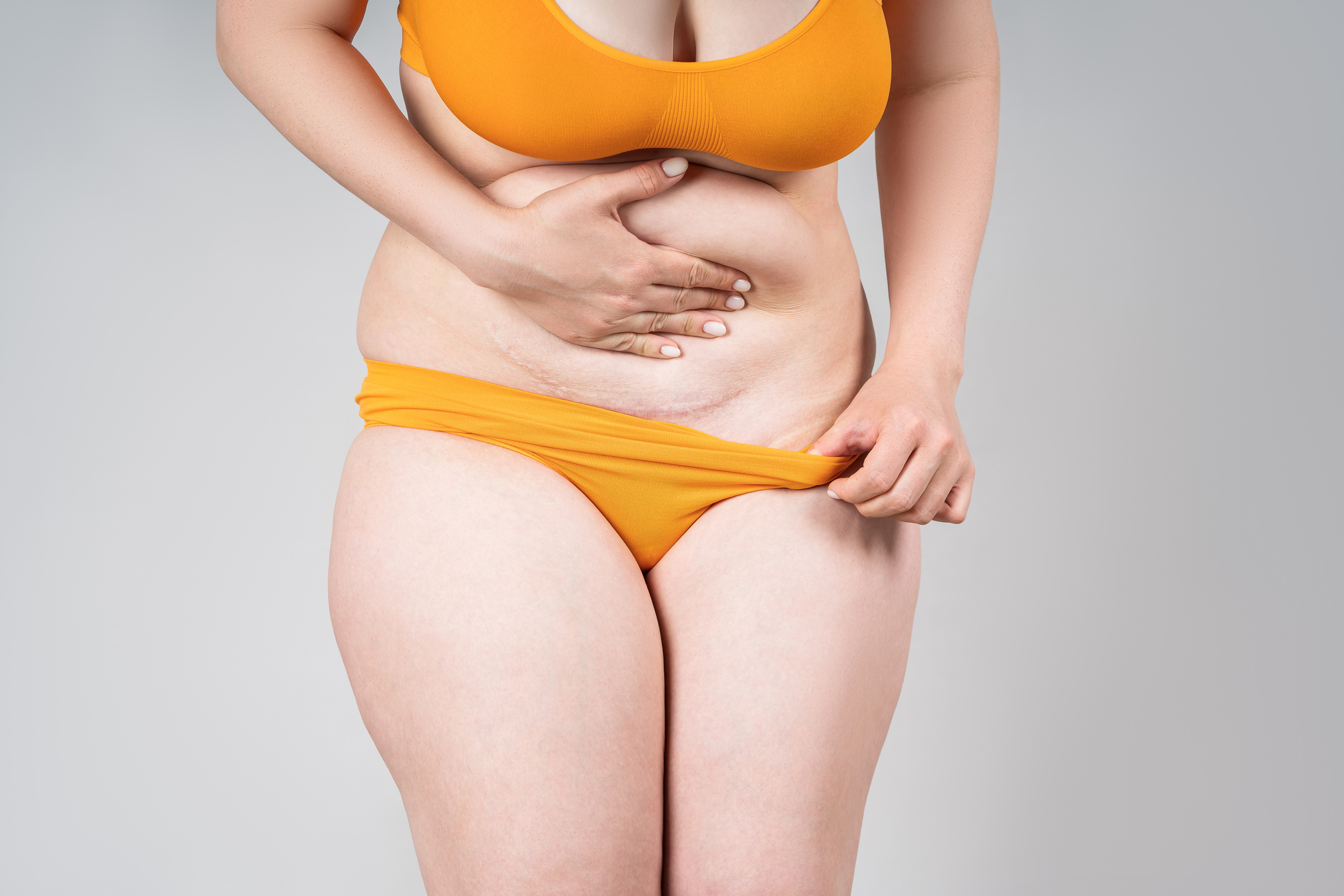 Female belly with a scar from a caesarean section